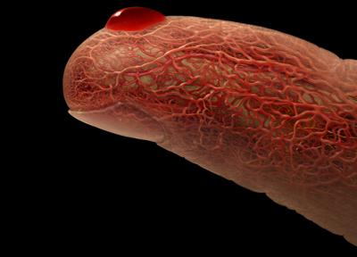 Cukorbetegek védelmében!0